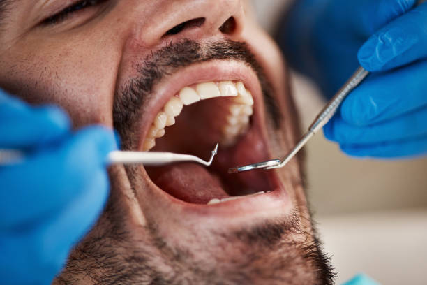 Best Emergency Root Canal Treatment in Madill, OK