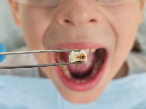 Best Emergency Dental Care for Trauma or Injury in Madill, OK